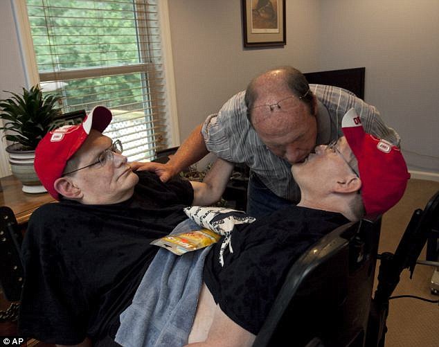 Morrem aos 68 anos os gêmeos siameses mais velhos do mundo