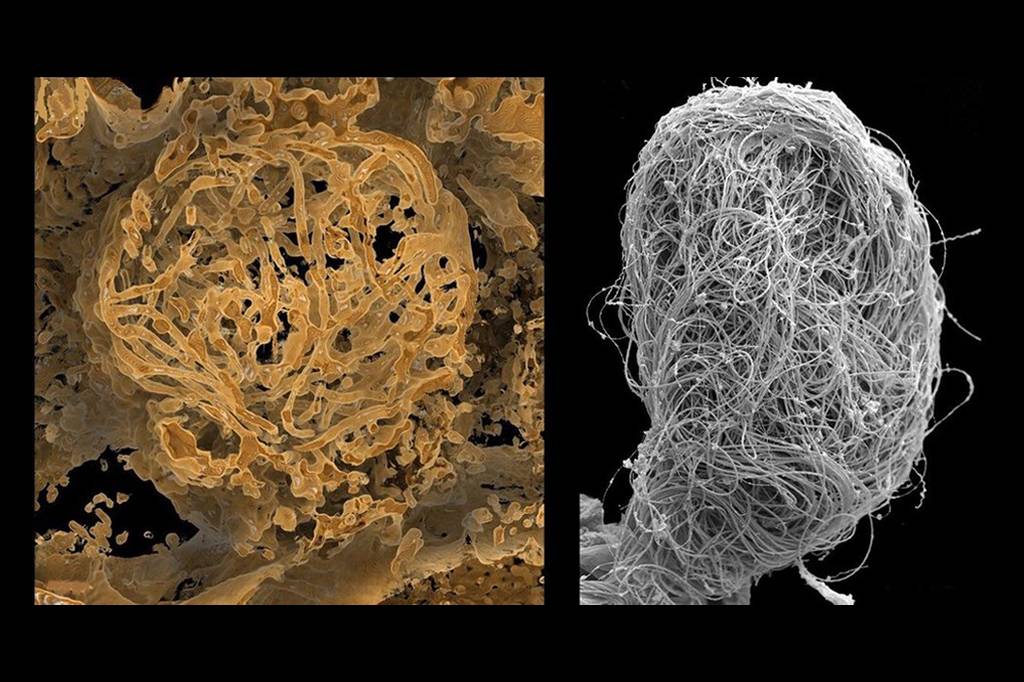 Cientistas descobrem células de esperma gigante com 100 milhões de anos