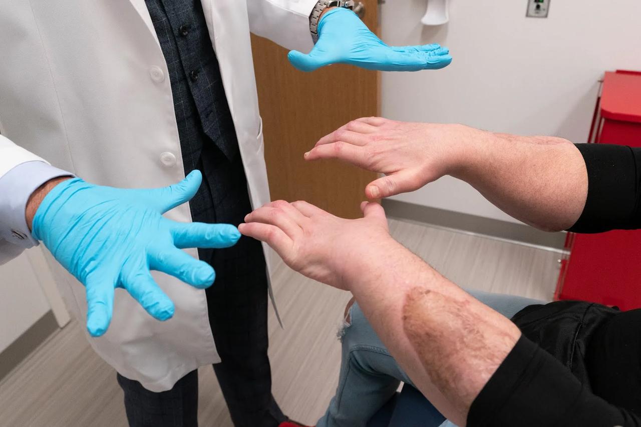 Homem recebe novos rosto e mãos em transplante raro